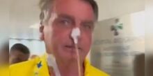 Após 12 horas de cirurgia, Bolsonaro se recupera