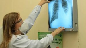 Prefeitura e CRTH intensificam ações para o combate à tuberculose em Dourados