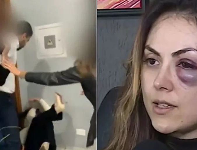 Colegas de trabalho intervém em briga, procuradora exibe hematomas