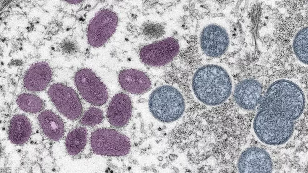 Vírus Monkeypox visto usando microscopia 