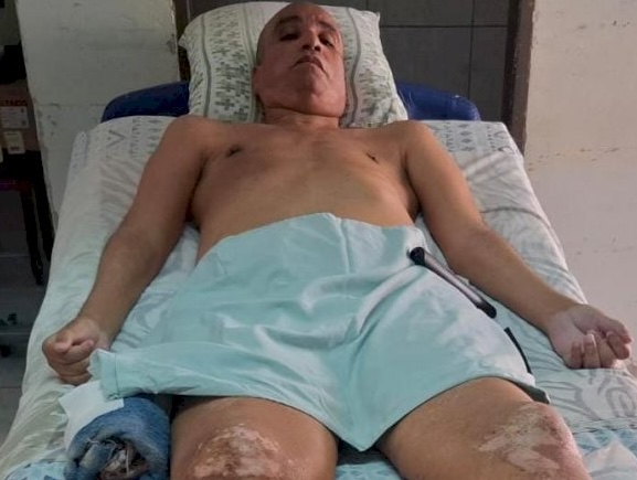 Sadi, acamado após acidente que o deixou tetraplégico