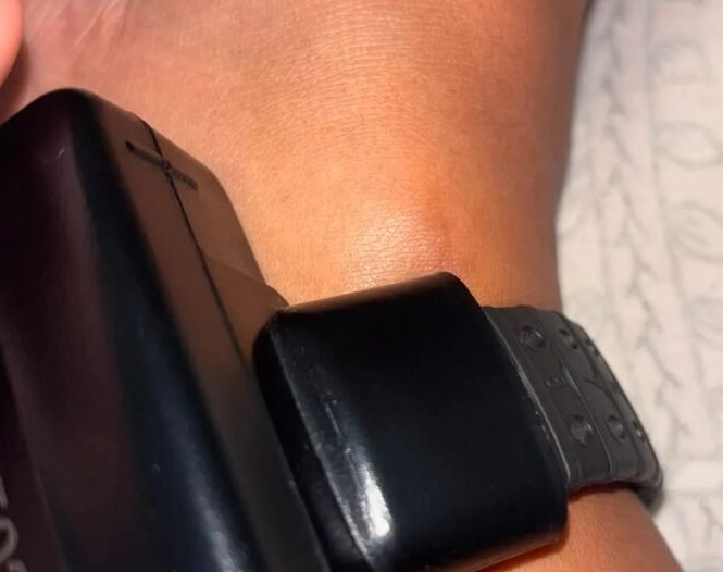 Mesmo sem dever, médica ainda usou tornozeleira por 19 dias